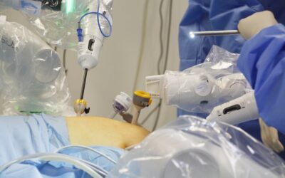 Rewolucja w cieszyńskiej medycynie: Robot Versius w Szpitalu Śląskim